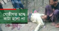 কানাইঘাটে বিচ্ছিন্ন সেই ‘পা’ মিলল পলিথিনে মোড়ানো