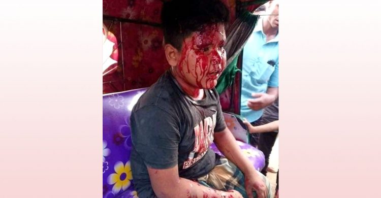 দোয়ারাবাজারে ১২ বছরের শিশুকে কূপিয়ে জখম, হত্যার চেষ্টা!